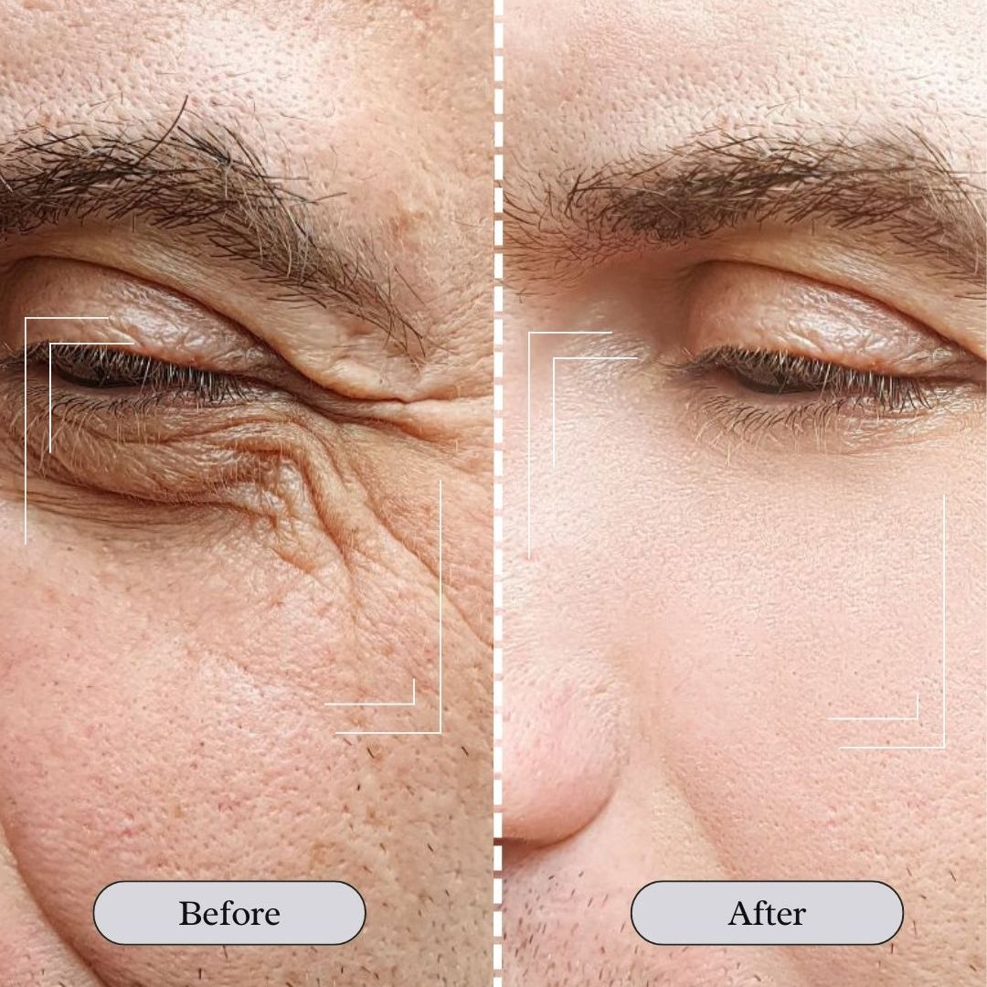 JARLENNE_LED_Light_Face_D_colletage_Mask