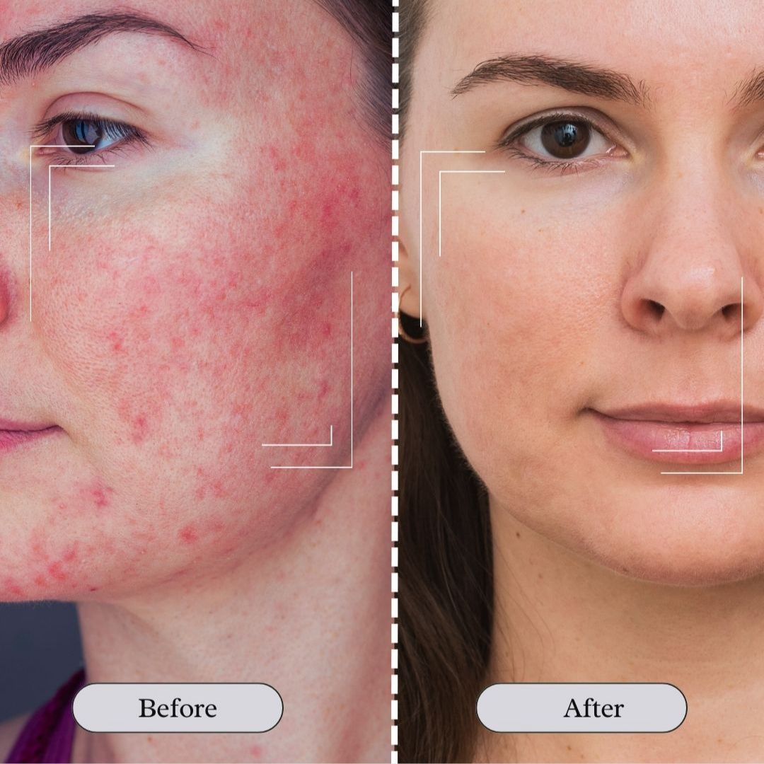 JARLENNE_LED_Light_Face_D_colletage_Mask