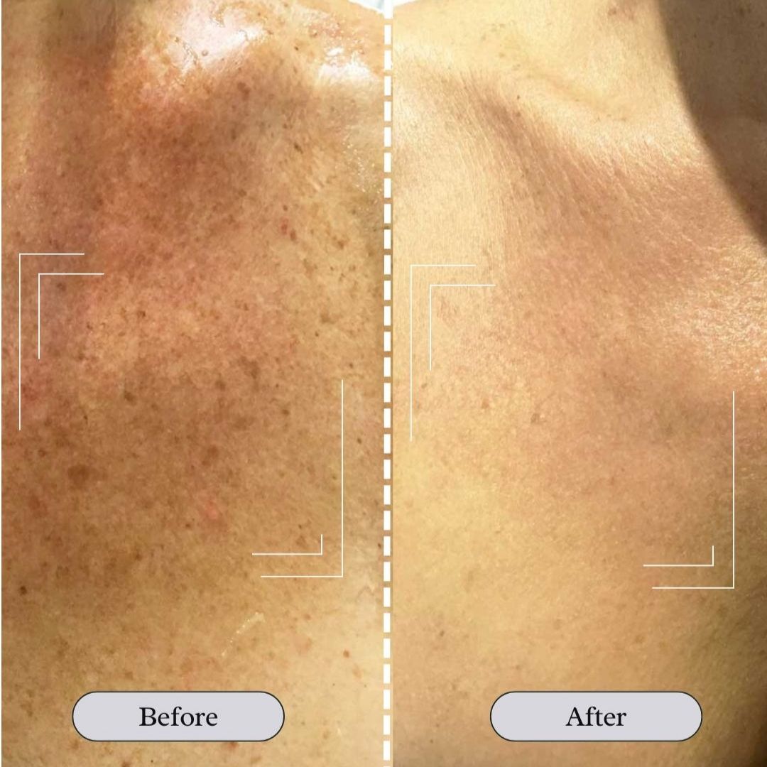 JARLENNE_LED_Light_Face_D_colletage_Mask