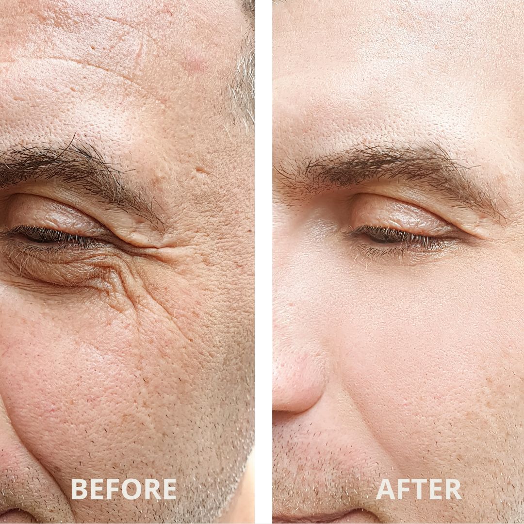 AURORA™ Advanced Under-Eye Renewal Therapy