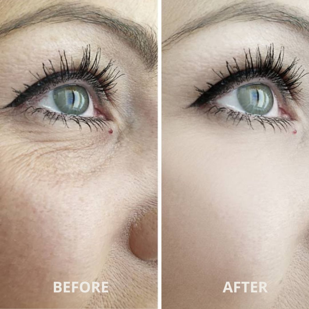 AURORA™ Advanced Under-Eye Renewal Therapy