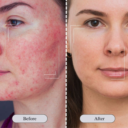 JARLENNE_LED_Light_Face_D_colletage_Mask