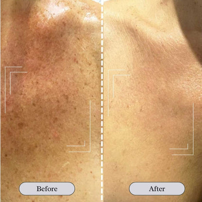 JARLENNE_LED_Light_Face_D_colletage_Mask